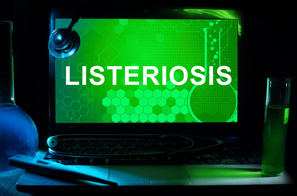 The Food Industry Under The Spotlight Amidst Listeriosis Outbreak